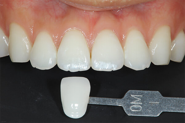 アフター（色の変化）