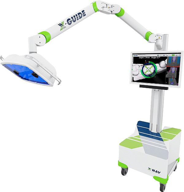 Xガイドの機械の写真