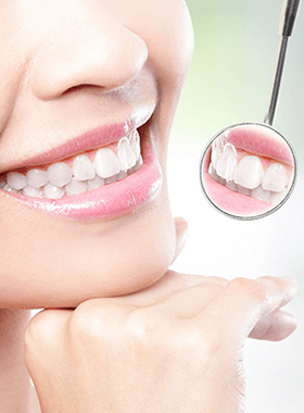 きれいな歯が並ぶ女性の口元