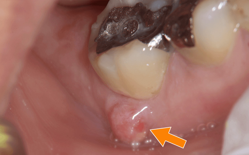 サイナストラクトの写真