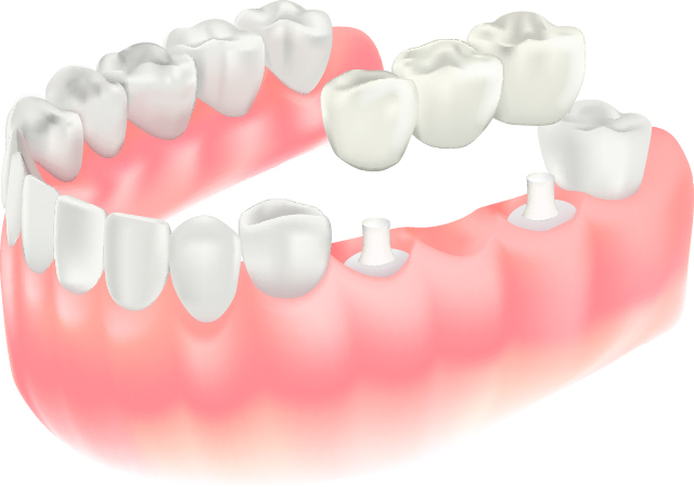 ブリッジのイラスト