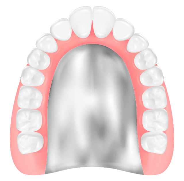金属床義歯のイラスト