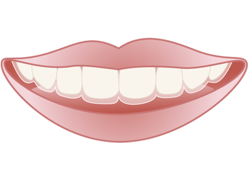 インビザライン