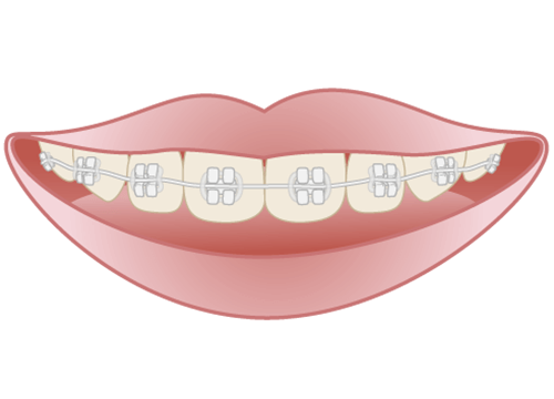 ホワイトワイヤー